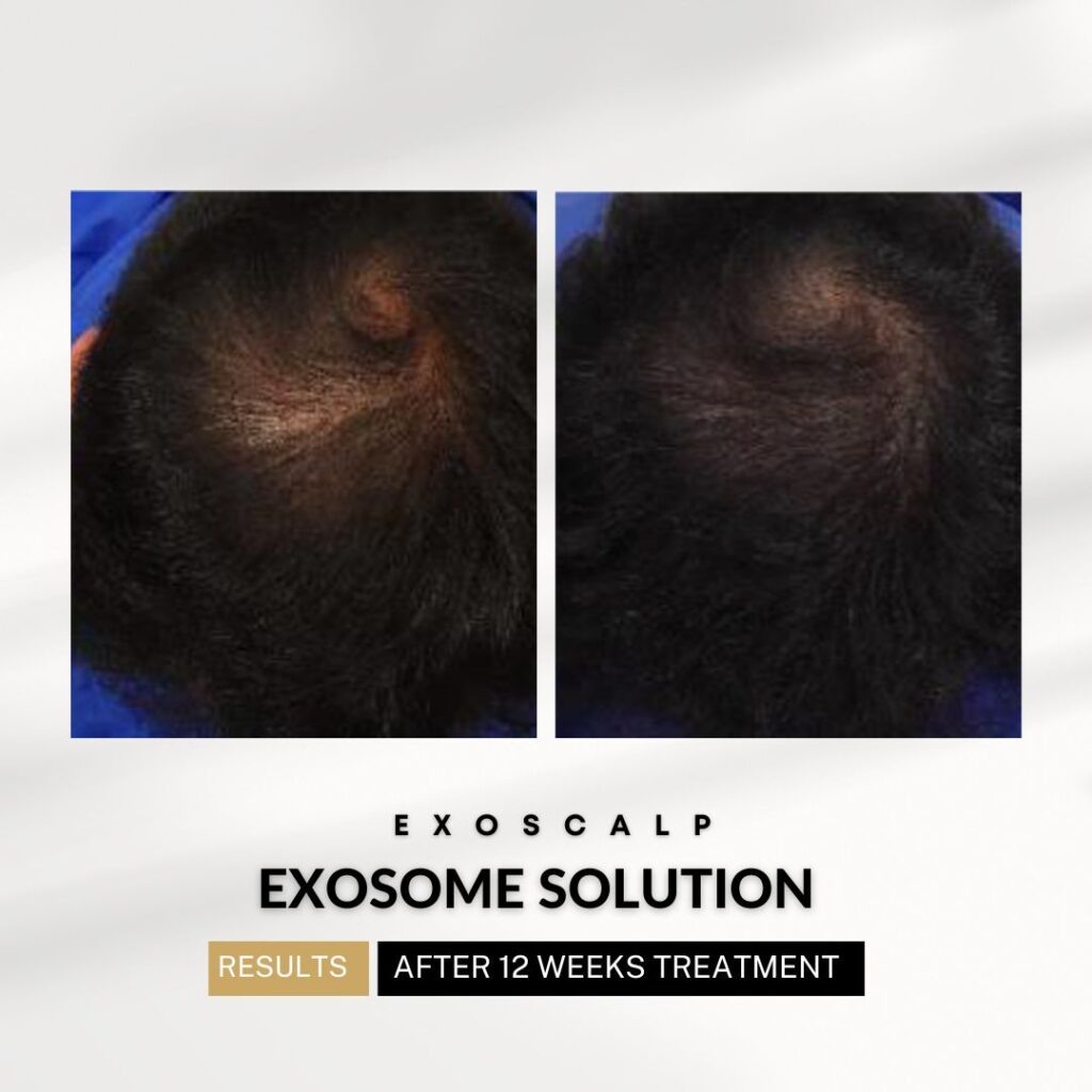 xr:d:DAF1npVRcAE:404,j:948432584418572323,t:24041417