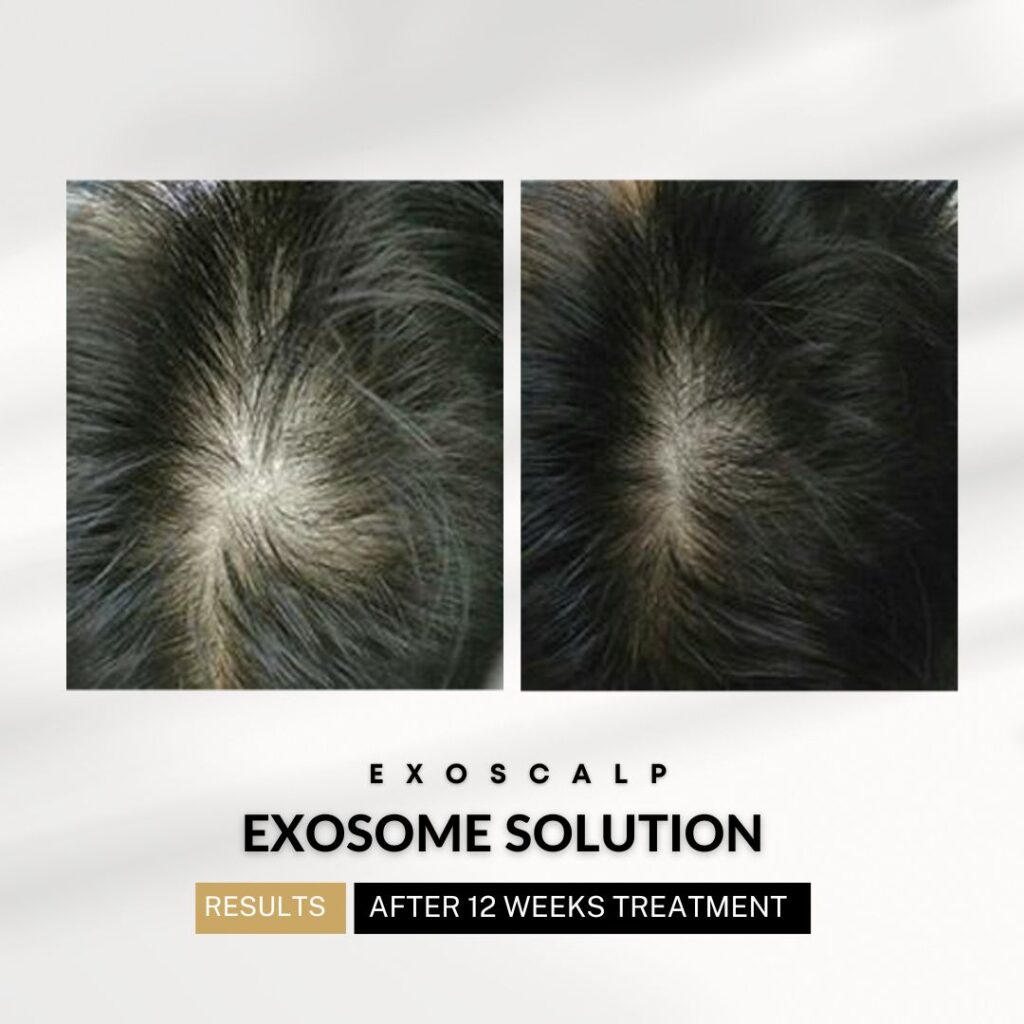 xr:d:DAF1npVRcAE:404,j:948432584418572323,t:24041417