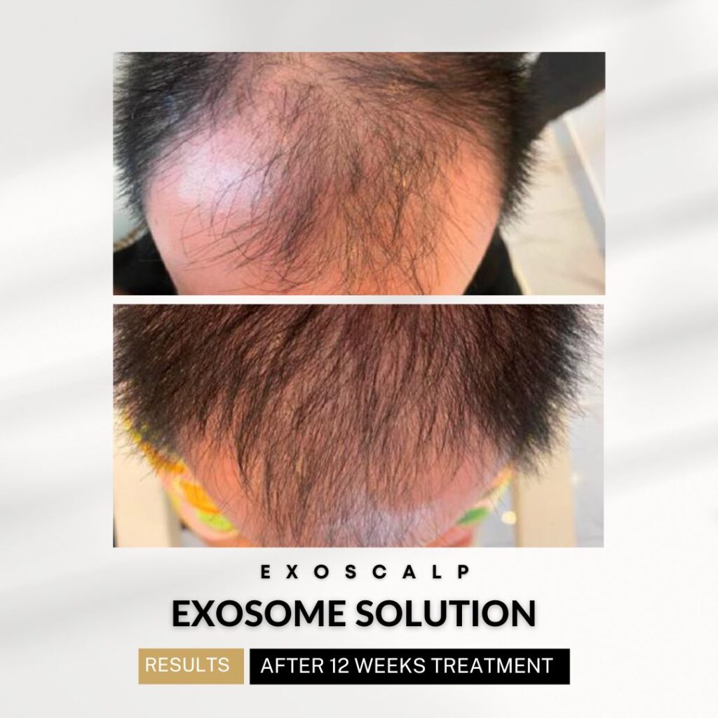 xr:d:DAF1npVRcAE:404,j:948432584418572323,t:24041417