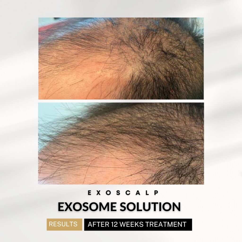 xr:d:DAF1npVRcAE:404,j:948432584418572323,t:24041417